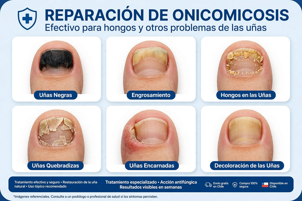 PACK 42 PARCHES ANTI HONGOS - Paga al Recibir