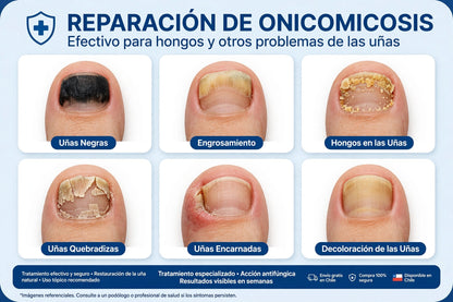 PACK 42 PARCHES ANTI HONGOS - Paga al Recibir